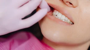 歯の検診をうける女性